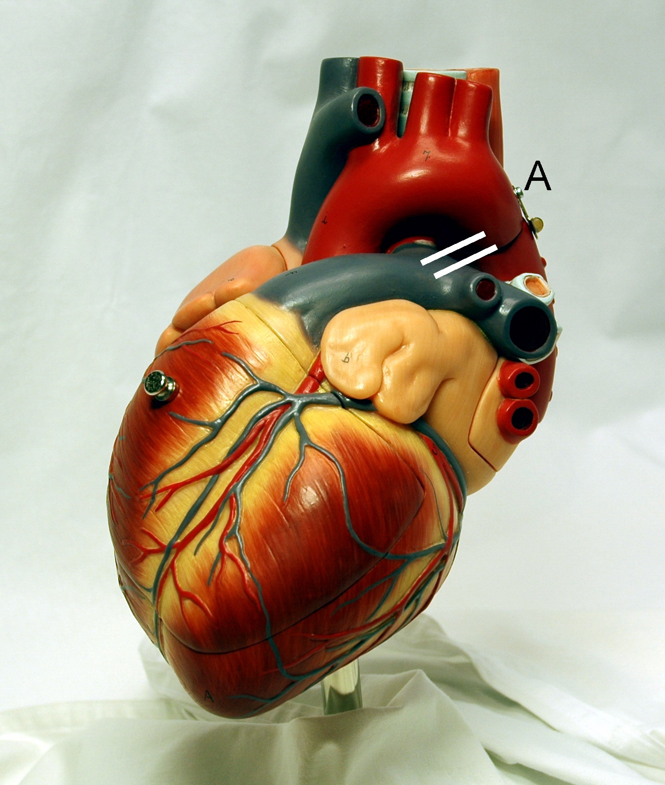 قلب، اندامی ماهیچه‌ای است و شامل آندوکارد، میوکارد و اپی‌کارد است.